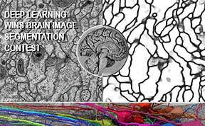 Deep Learning Wins 2012 Brain Image Segmentation Contest