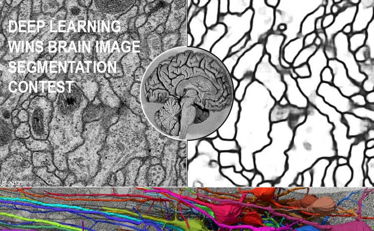 1 March 2012: Deep Learning Wins
2012 Brain Image Segmentation Contest