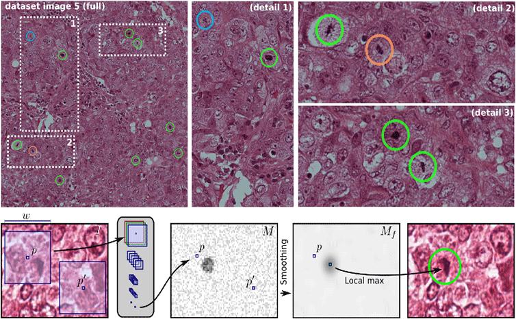 Deep Learning Wins Contest on Mitosis Detection in Breast Cancer Histological Images
