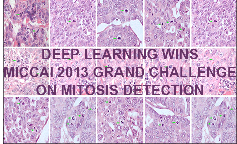 Deep Learning Wins MICCAI 2013 Grand Challenge on Mitosis Detection