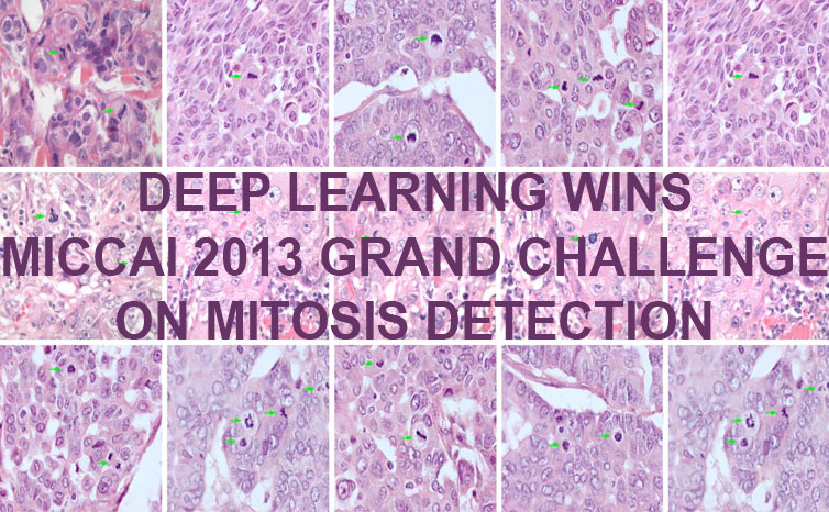 First Deep Learner to win a contest on object detection in large images - First Deep Learner to win a medical imaging contest